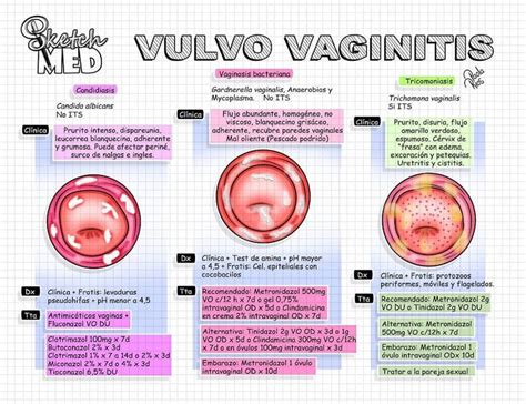 Sketch Med Paola Rios On Instagram En Caso De Vulvovaginitis Tener