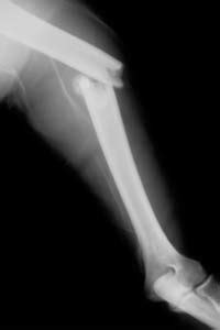 Matlab And Imagej Detecting Bone Fracture Stack Overflow