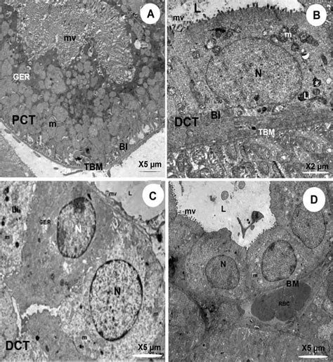 A-D. Electron micrographs of a proximal convoluted tubule cells (A ...