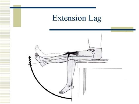 Orthopaedic Neurology Diagnostic Guide to Neurological Levels Motor