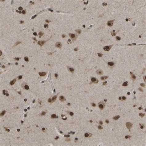 Anti SPEN Antibody Produced In Rabbit