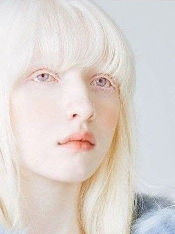 Albino Person Albino Girl Skin Drawing Face Drawing Reference