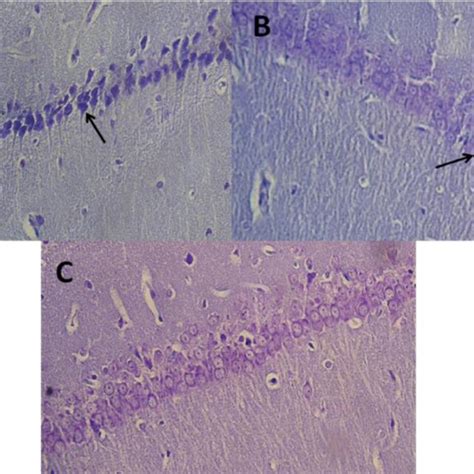 Nissl Staining Of Hippocampal CA1 Pyramidal Cells Neonates Of Rats In