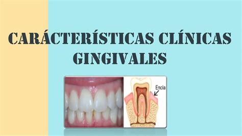 Características Clínicas Gingivales Tati Dent uDocz