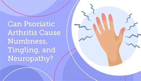 Can Psoriatic Arthritis Cause Numbness Tingling And Neuropathy Mypsoriasisteam