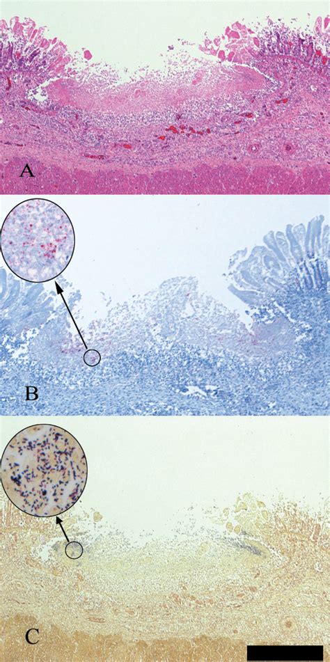 Clostridium Perfringens Gram Stain