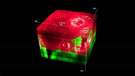 Two Photon Autofluorescence Imaging Of Human Skin Biopsy Youtube