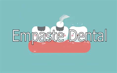 Empaste Dental ¿qué Es ¿cómo Se Realiza 【2020】