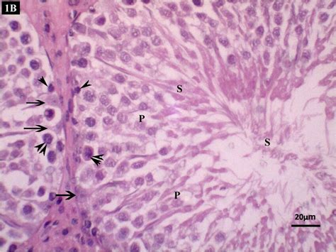 1B The Lumen Of The Seminiferous Tubules Lined With Stratified