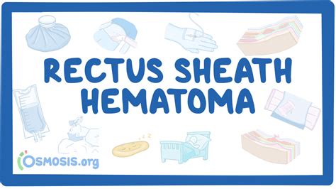 Rectus Sheath Hematoma Video Meaning Osmosis