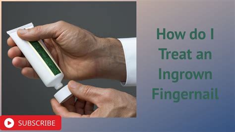 How Do I Treat An Ingrown Fingernail Youtube