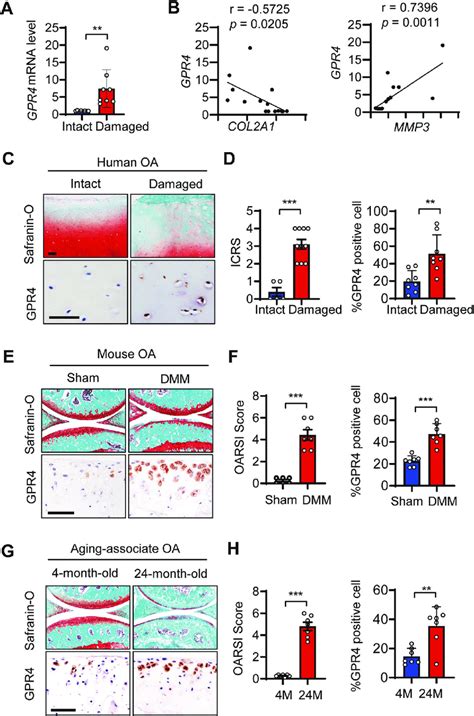 Gpr Expression Was Upregulated In Human And Mouse Oa Articular