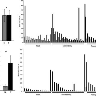 Bmi And Hmga Expressions In Head And Neck Squamous Cell Carcinoma