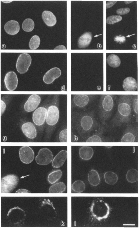 Indirect Immunofluorescence Micrographs Of Fixed Nrk Cells