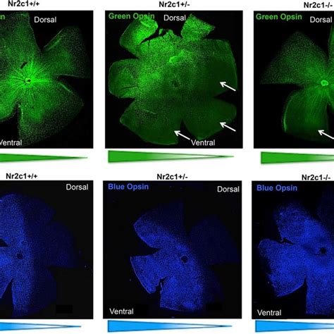 Green Opsin M Opsin Expressing Cone Cells Affected In Central And