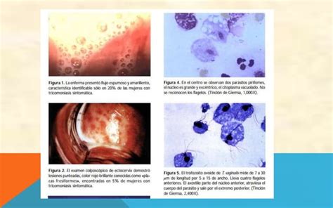 Procesos Infecciosos Y Parasitarios Parte Ppt