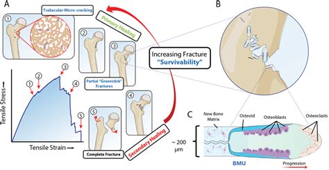 A Schematic Illustrations Of Fracture Events With Increasing Severity