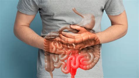 Understanding Inflammatory Bowel Disease Causes Symptoms Innovative