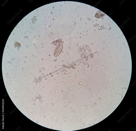 Parasite In Stool Under 40x Light Microscopy Enterobius Vermicularis Hot Sex Picture