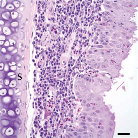 Nasal Septum Of A Cliff Swallow With Rhinitis There Is Hyperplasia Of