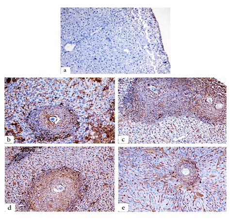 Figure3 Immunohistochemical Staining Of Cd3 Expression Of Liver Download Scientific Diagram