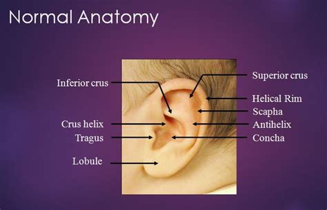 Infant Ear Molding New York, NY - Ear Molding NYC