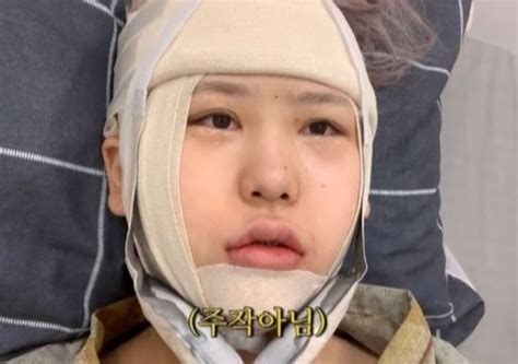 Hot girl Hàn Quốc phẫu thuật thẩm mỹ toàn cơ thể