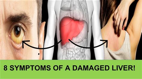 8 Symptoms Of A Damaged Liver Youtube