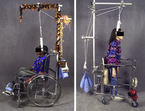 Preoperative Halo Gravity Traction For Severe Pediatric Spinal Deformity Complications