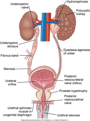 Nurs Ch Alterations Of Renal And Urinary Tract Function