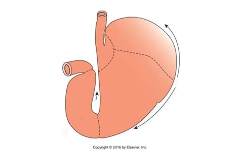 Monogastric Stomach Diagram Quizlet