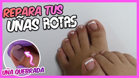 Aprender acerca 31 imagen como reparar uñas de los pies Abzlocal mx