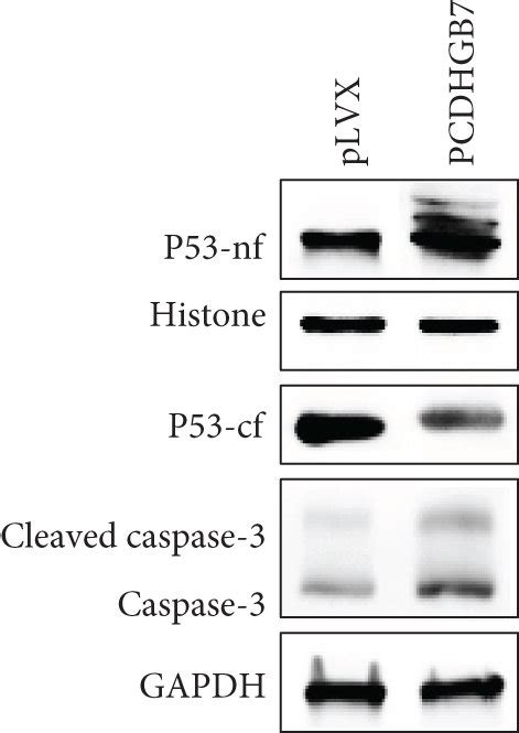 Western Blotting Analysis Of Expression Of P53 Nf Nuclear Fraction Of Download Scientific