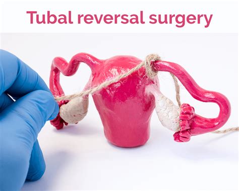 Tubal Reversal Surgery Dr Sankar DasMahapatra Gynaecologist