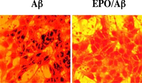 Erythropoietin Epo Prevents Dna Fragmentation During β Amyloid Aβ