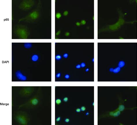 Activation Of The Nfkb P Subunit In Macrophage Differentiated Thp