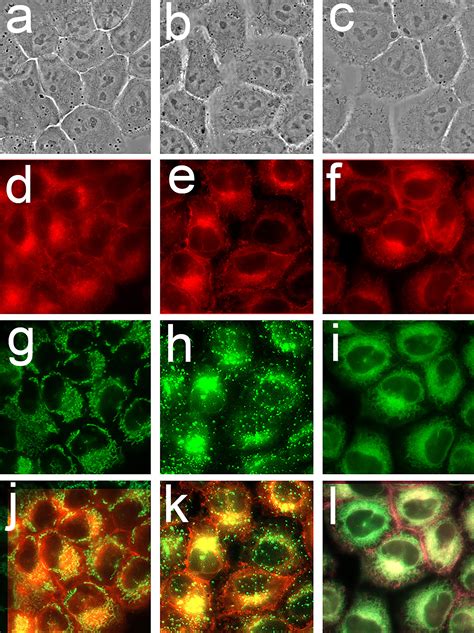 Apoptosis Paraptosis And Autophagy Death And Survival Pathways