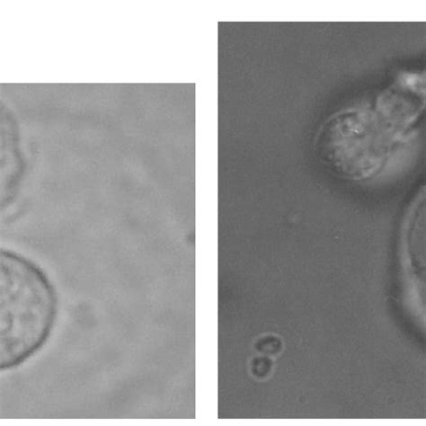(PDF) Exit Mechanisms of Intracellular Parasites from their Host Cells