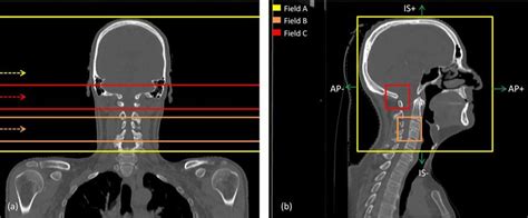 coronal   sagittal  views    patient geometry