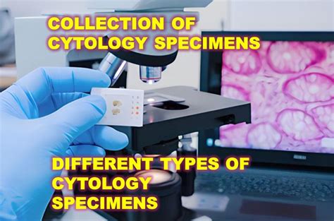 Cytology Specimen A Comprehensive Guide To Collection And Types