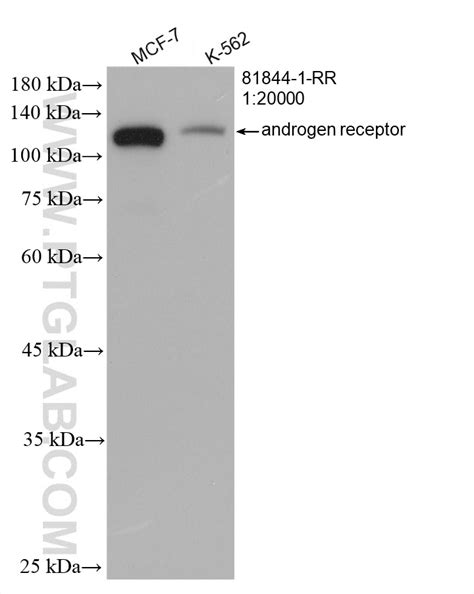 Androgen Receptor Antibody Rr Proteintech