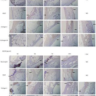 Immunohistochemical Staining For Neutrophils VEGF Collagen I And