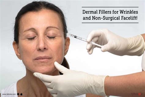 Dermal Fillers For Wrinkles And Non Surgical Facelift By Radiance