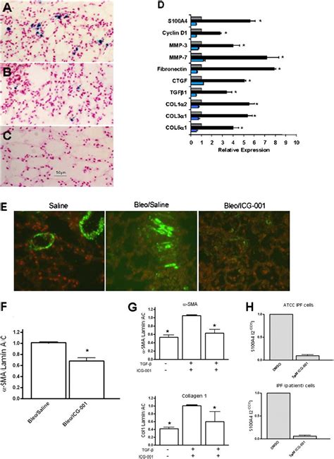 Inhibition of Wnt β catenin CREB binding protein CBP signaling