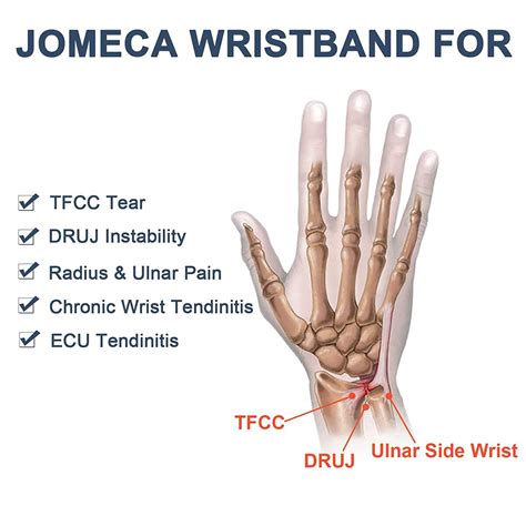 Ulnar Wrist Pain Causes