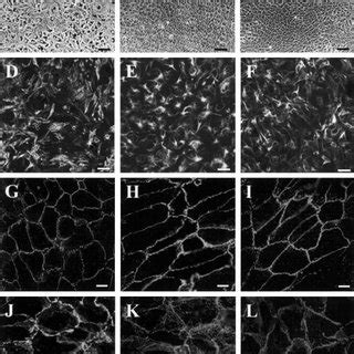 Phase Contrast Photomicrographs Of A A Primary Donor Rpe Cell Culture