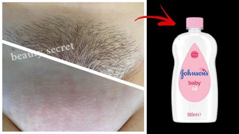 Pubic Hair Removal Permanent Facial Hair Removal Hair Removal Diy