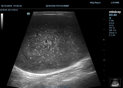 Ультразвуковая диагностика (снимки) - круглосуточная ветеринарная ...