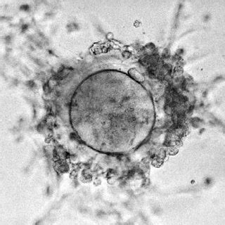 Mature Oocyte Demonstrating The First Polar Body Extruded After