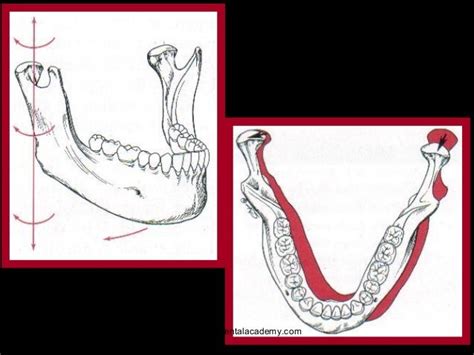 Mandibular Movements Labial Orthodontics